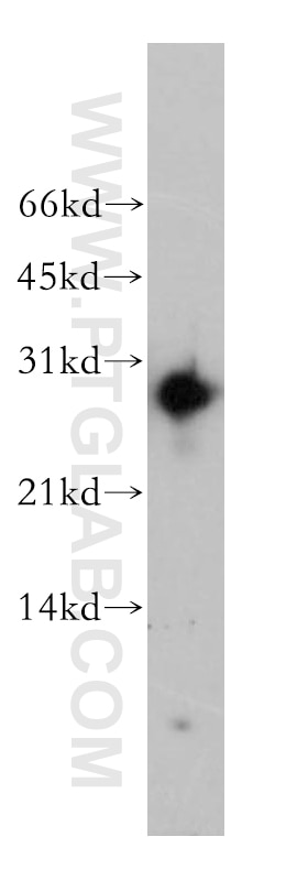 Western Blot (WB) analysis of Y79 cells using AK3 Polyclonal antibody (12562-1-AP)