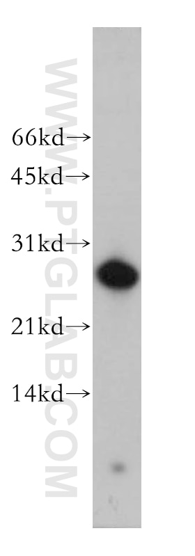 Western Blot (WB) analysis of human placenta tissue using AK3 Polyclonal antibody (12562-1-AP)