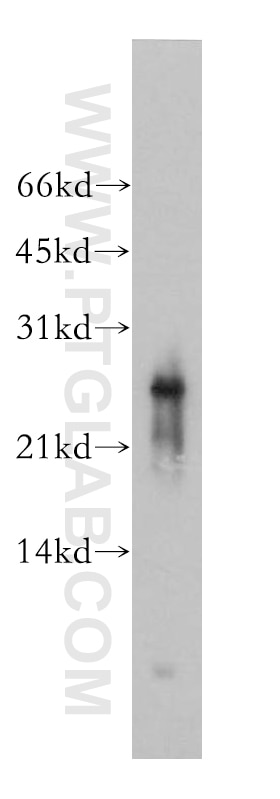 Western Blot (WB) analysis of BxPC-3 cells using AK3 Polyclonal antibody (12562-1-AP)