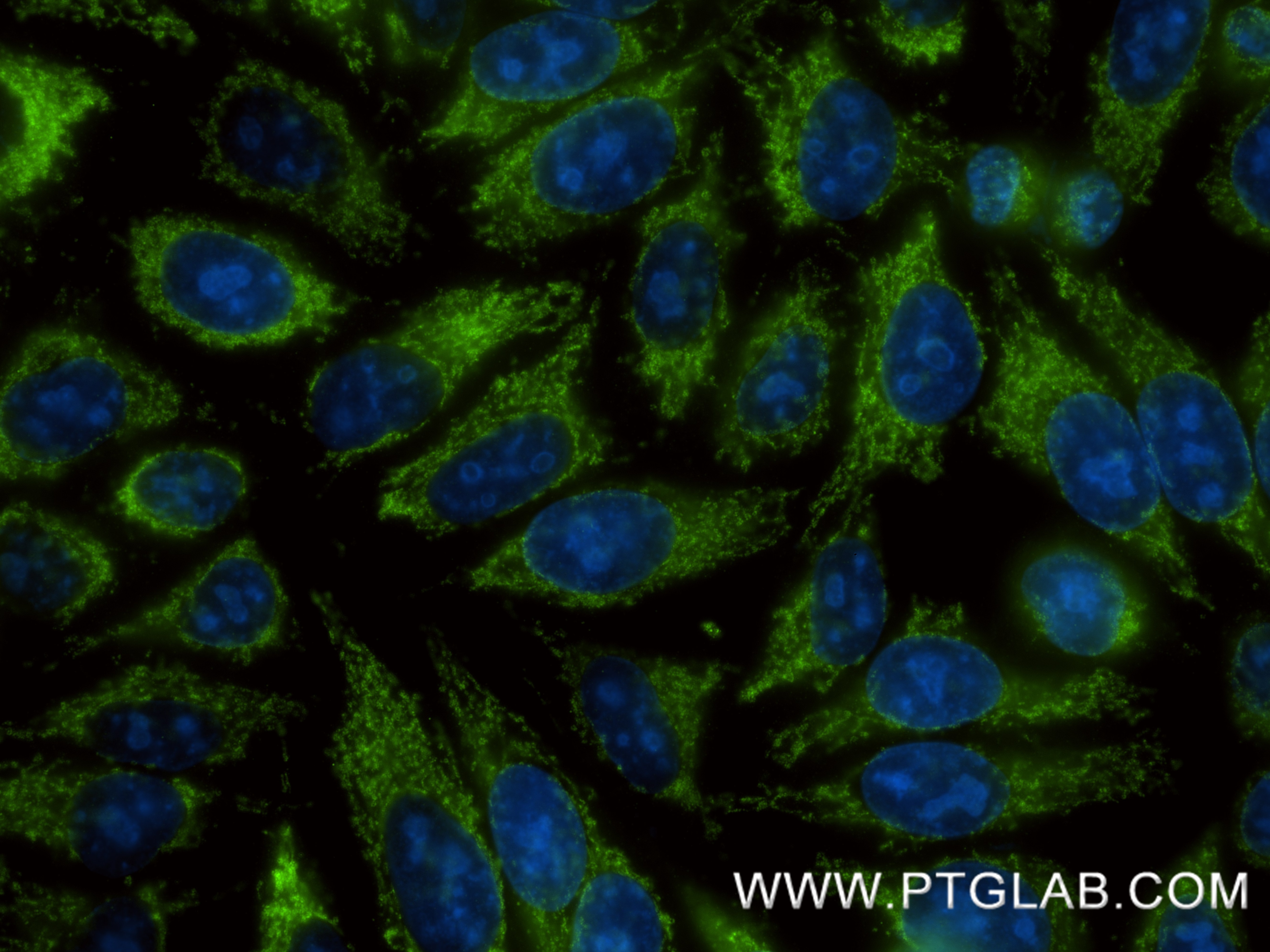 Immunofluorescence (IF) / fluorescent staining of HepG2 cells using AK3 Recombinant monoclonal antibody (87090-3-RR)