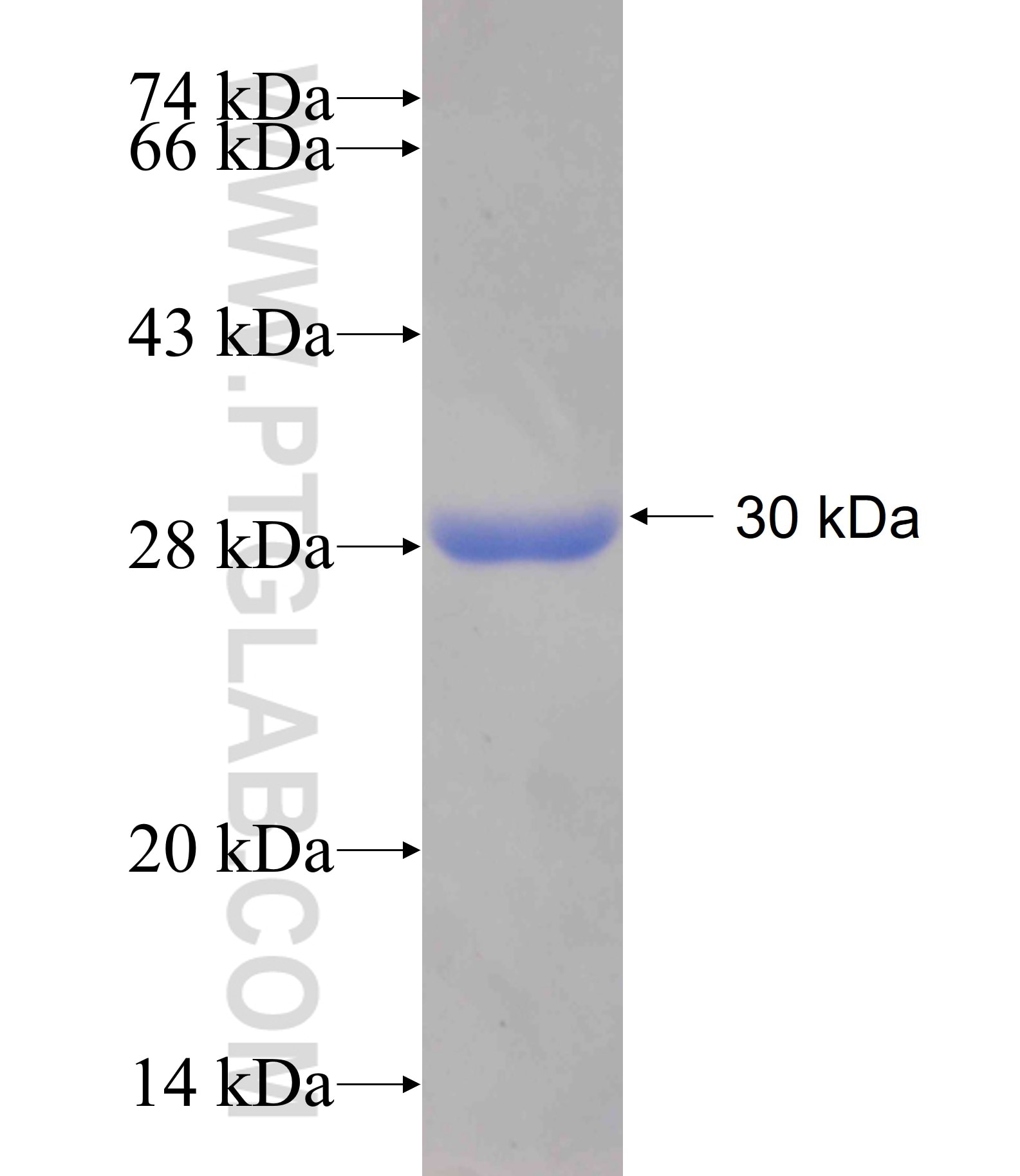 AK3 fusion protein Ag17424 SDS-PAGE