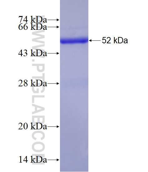 AK3 fusion protein Ag3146 SDS-PAGE