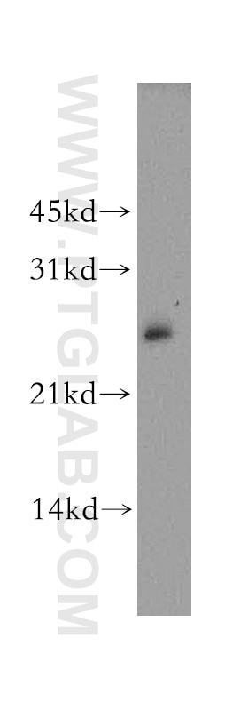Western Blot (WB) analysis of MCF-7 cells using AK3L1 Polyclonal antibody (13206-1-AP)