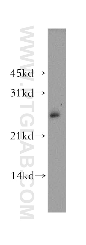 WB analysis of MCF-7 using 13206-1-AP