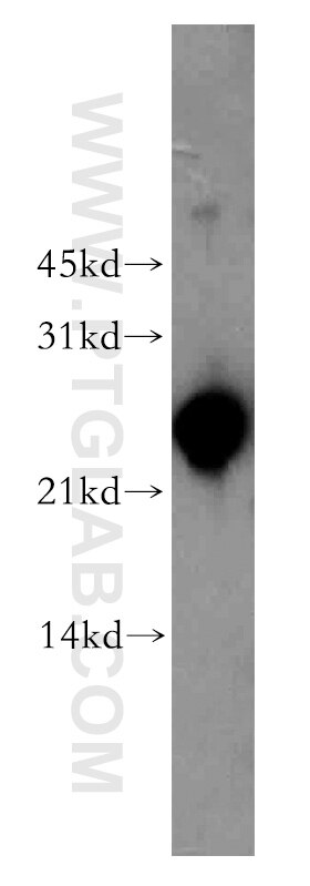 Western Blot (WB) analysis of human liver tissue using AK3L1 Polyclonal antibody (13206-1-AP)
