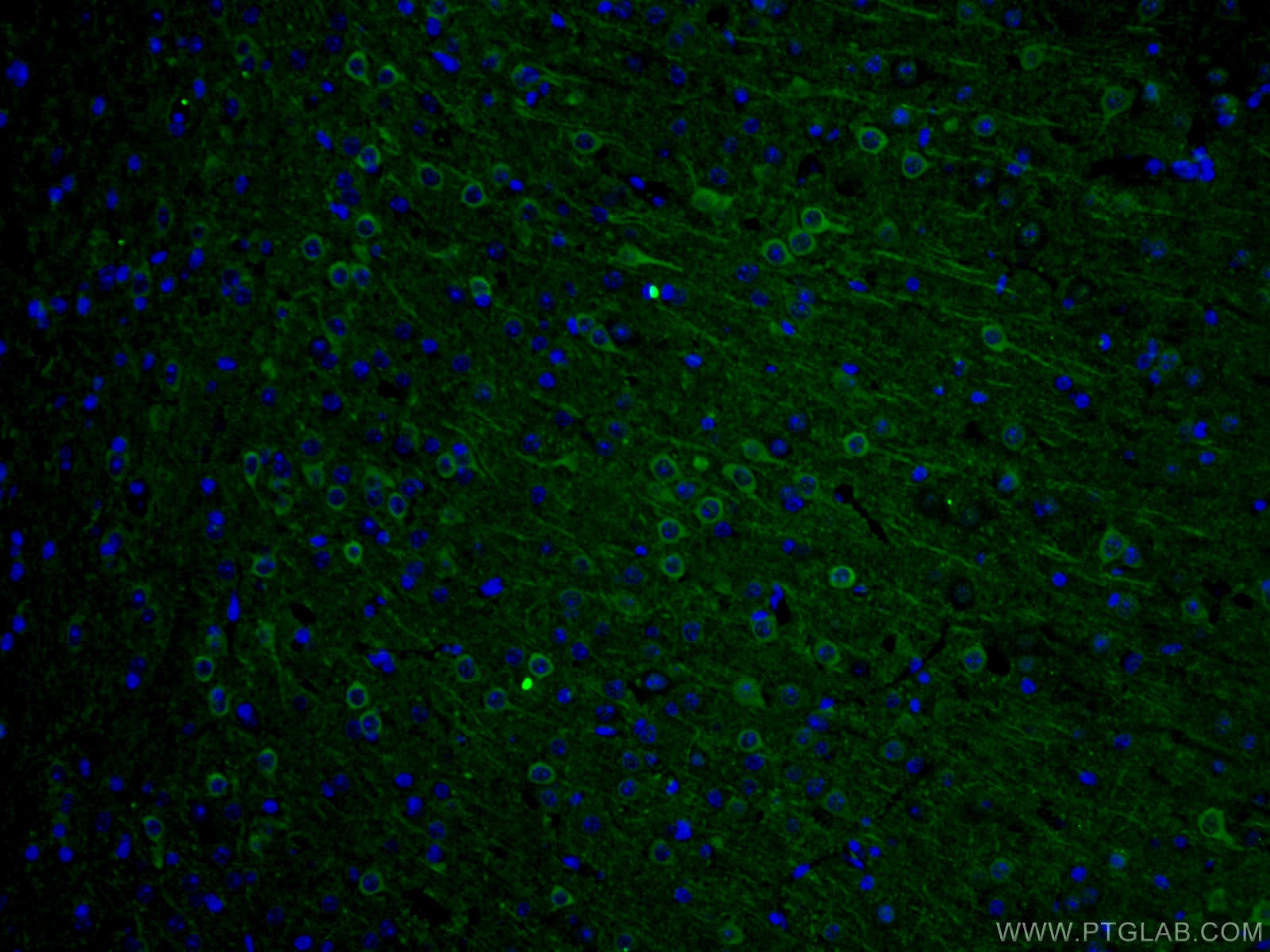 Immunofluorescence (IF) / fluorescent staining of mouse brain tissue using AK5 Polyclonal antibody (12510-2-AP)