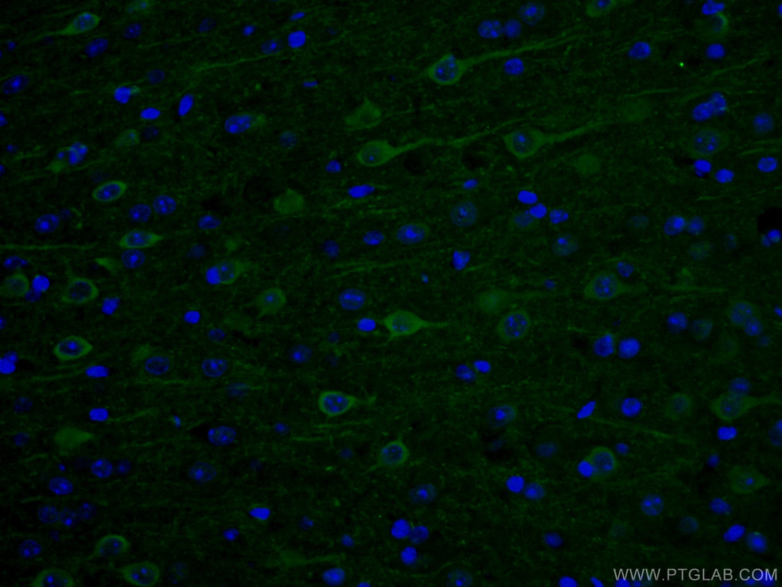 Immunofluorescence (IF) / fluorescent staining of mouse brain tissue using AK5 Polyclonal antibody (12510-2-AP)