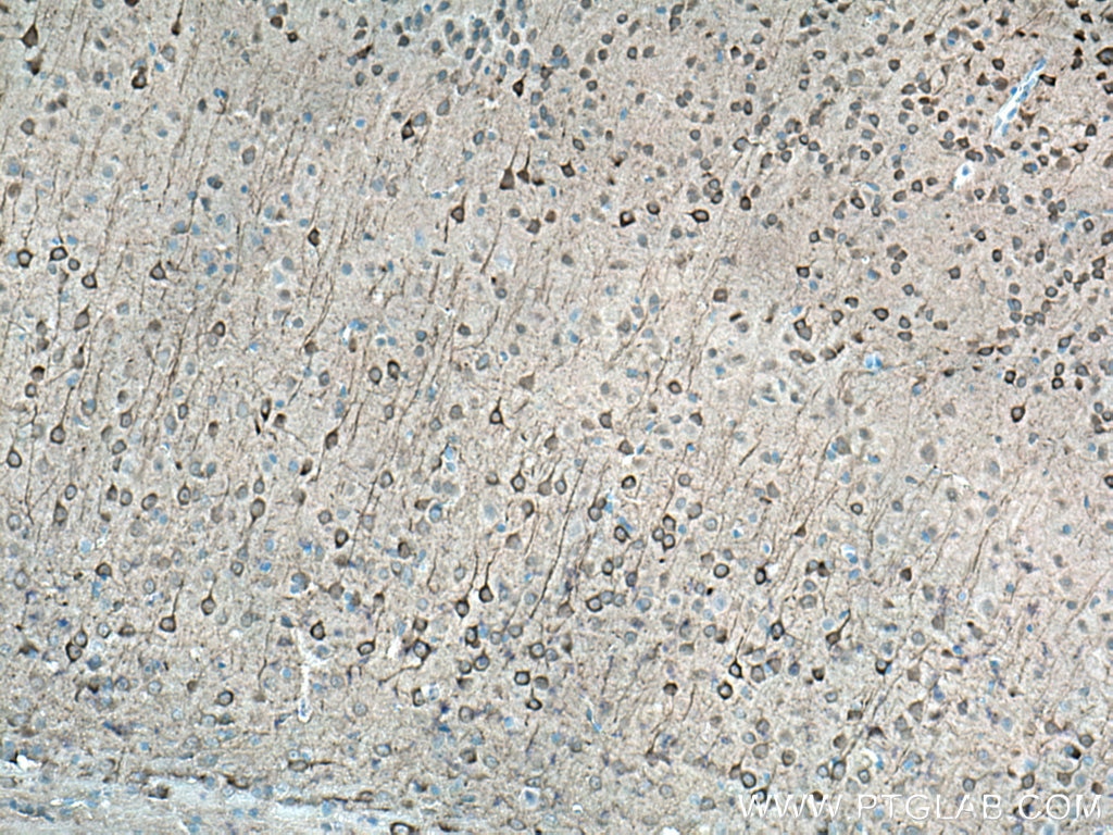 Immunohistochemistry (IHC) staining of mouse brain tissue using AK5 Polyclonal antibody (12510-2-AP)