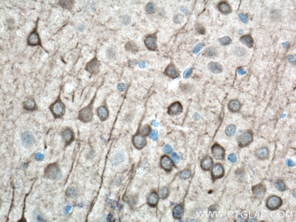 Immunohistochemistry (IHC) staining of mouse brain tissue using AK5 Polyclonal antibody (12510-2-AP)