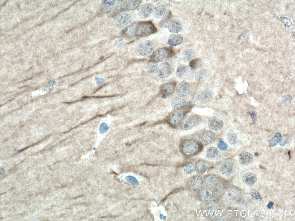 Immunohistochemistry (IHC) staining of mouse brain tissue using AK5 Polyclonal antibody (12510-2-AP)