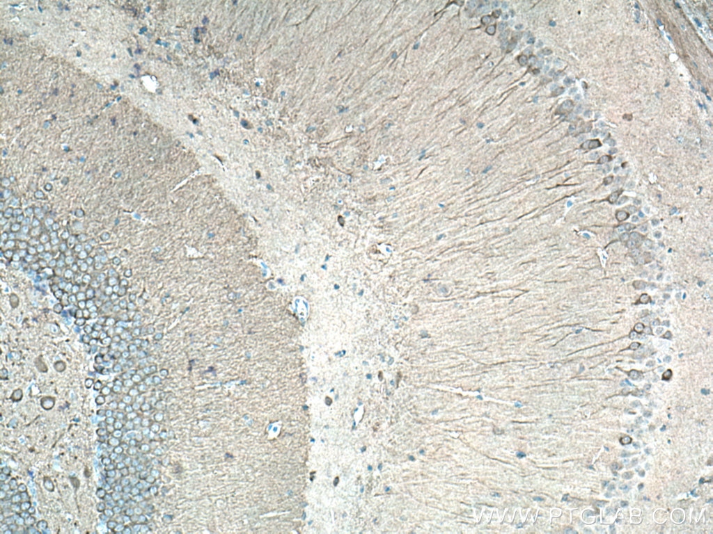 Immunohistochemistry (IHC) staining of mouse brain tissue using AK5 Polyclonal antibody (12510-2-AP)