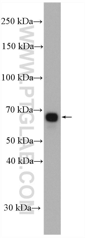 Western Blot (WB) analysis of mouse cerebellum tissue using AK5 Polyclonal antibody (12510-2-AP)