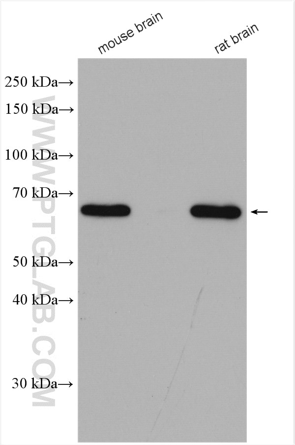 Western Blot (WB) analysis of various lysates using AK5 Polyclonal antibody (12510-2-AP)