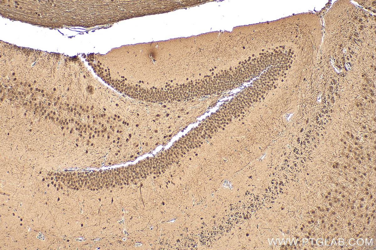 Immunohistochemistry (IHC) staining of mouse brain tissue using AK6 Polyclonal antibody (30517-1-AP)