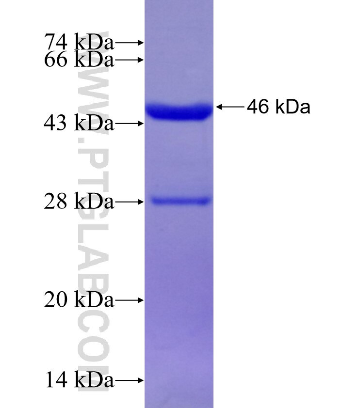 AK6 fusion protein Ag29330 SDS-PAGE