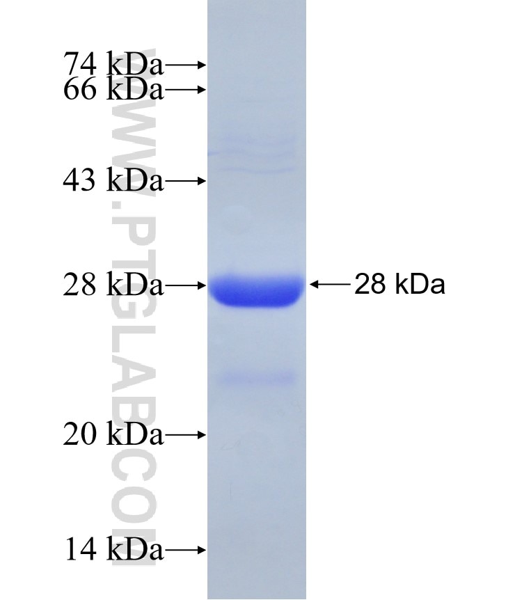 AK6 fusion protein Ag29518 SDS-PAGE