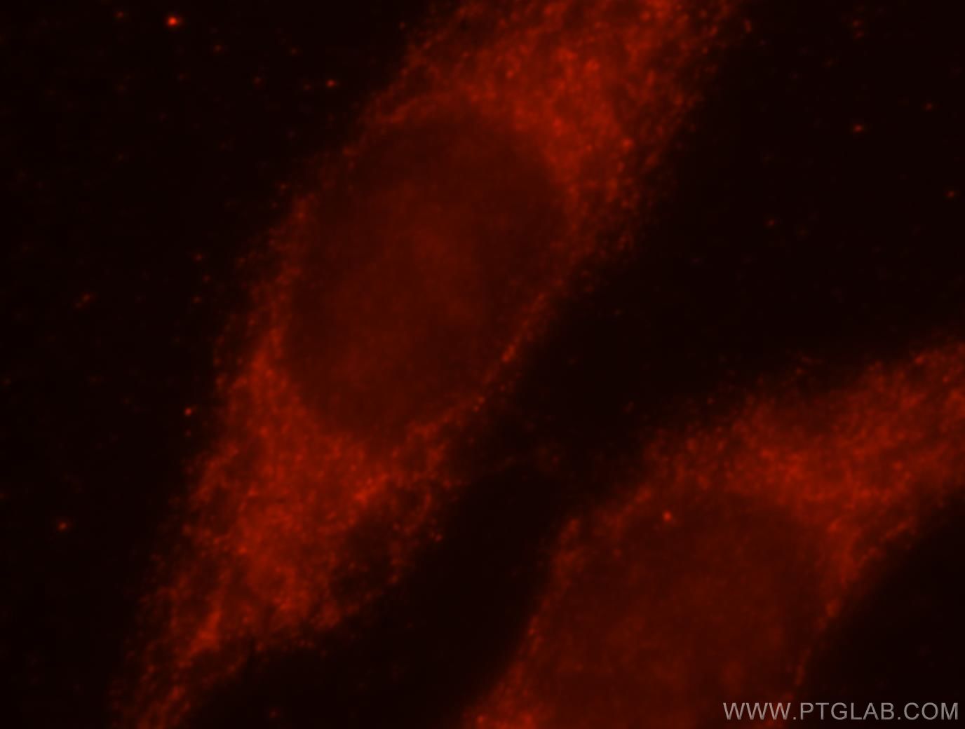 Immunofluorescence (IF) / fluorescent staining of MCF-7 cells using AKAP1 Polyclonal antibody (15618-1-AP)