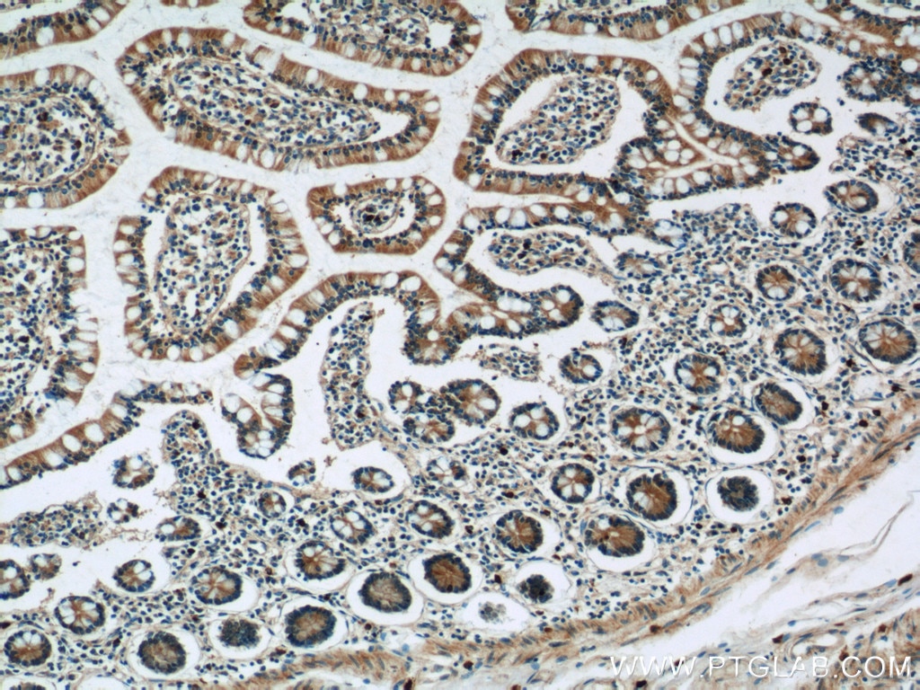Immunohistochemistry (IHC) staining of human small intestine tissue using AKAP1 Polyclonal antibody (15618-1-AP)
