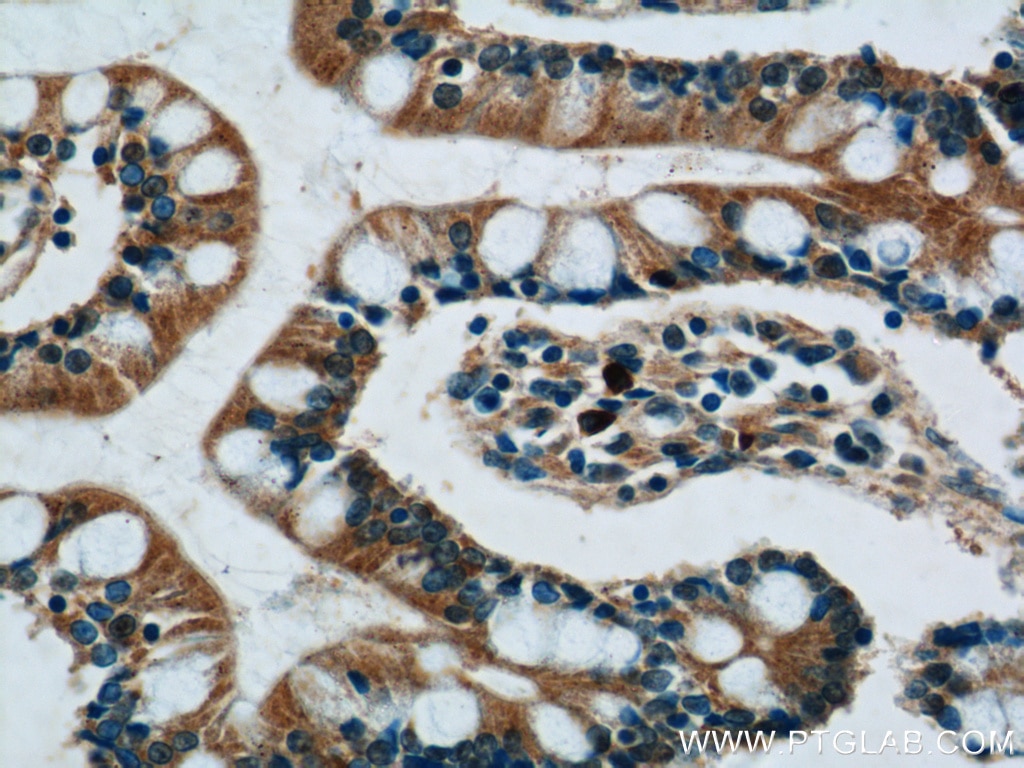 Immunohistochemistry (IHC) staining of human small intestine tissue using AKAP1 Polyclonal antibody (15618-1-AP)