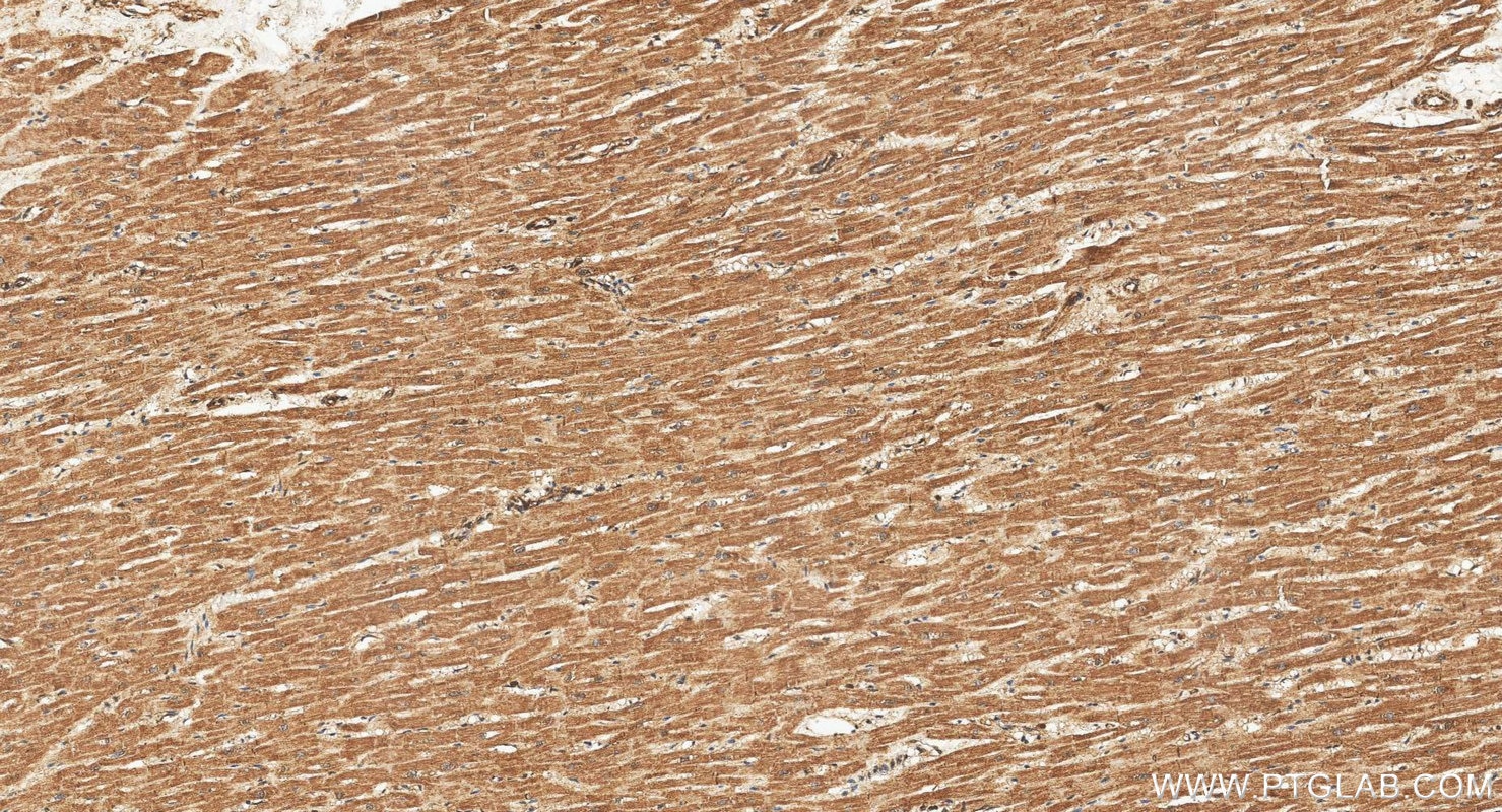 IHC staining of human heart using 15618-1-AP Immunohistochemistry (IHC) staining of human heart tissue using AKAP1 Polyclonal antibody (15618-1-AP)