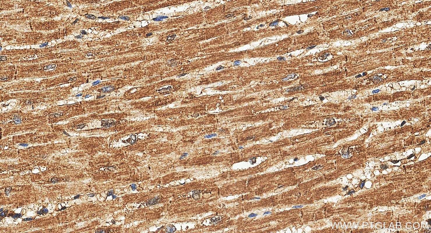 IHC staining of human heart using 15618-1-AP Immunohistochemistry (IHC) staining of human heart tissue using AKAP1 Polyclonal antibody (15618-1-AP)