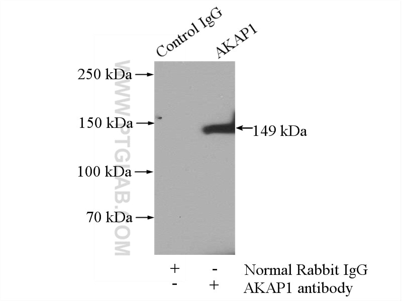 Immunoprecipitation (IP) experiment of PC-3 cells using AKAP1 Polyclonal antibody (15618-1-AP)
