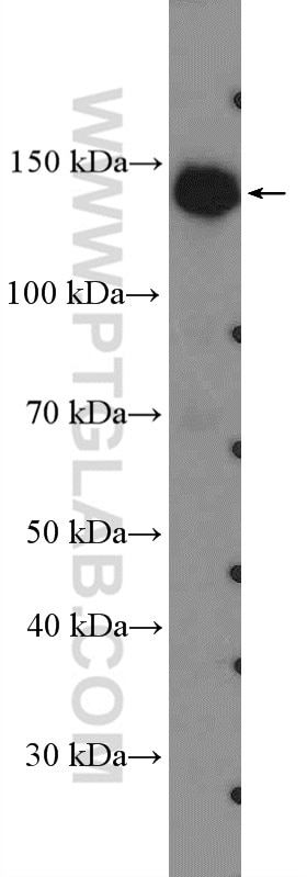 Western Blot (WB) analysis of MCF-7 cells using AKAP1 Polyclonal antibody (15618-1-AP)