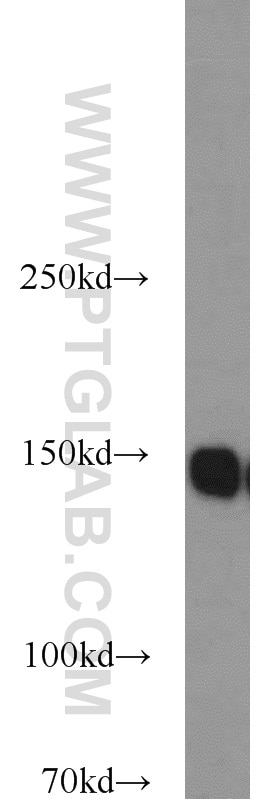 Western Blot (WB) analysis of HeLa cells using AKAP1 Polyclonal antibody (15618-1-AP)