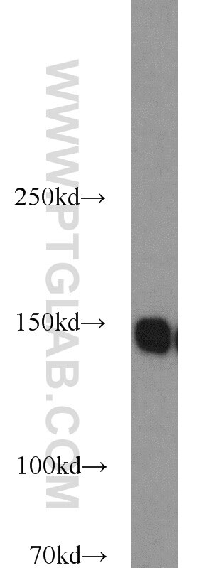 WB analysis of HeLa using 15618-1-AP