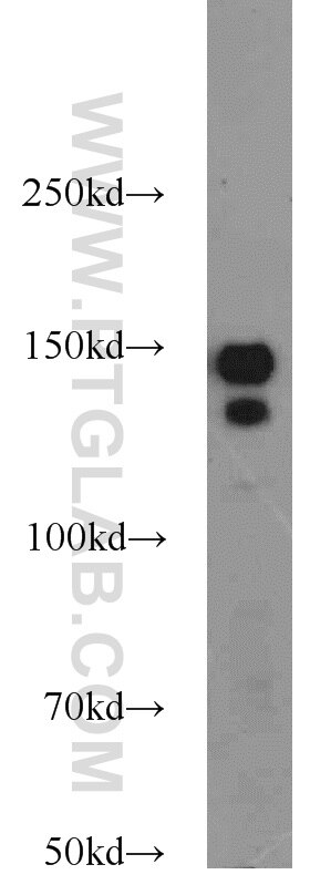 Western Blot (WB) analysis of PC-3 cells using AKAP1 Polyclonal antibody (15618-1-AP)