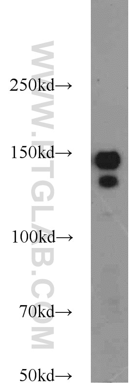 WB analysis of PC-3 using 15618-1-AP