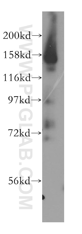 Western Blot (WB) analysis of human liver tissue using AKAP1 Polyclonal antibody (15618-1-AP)