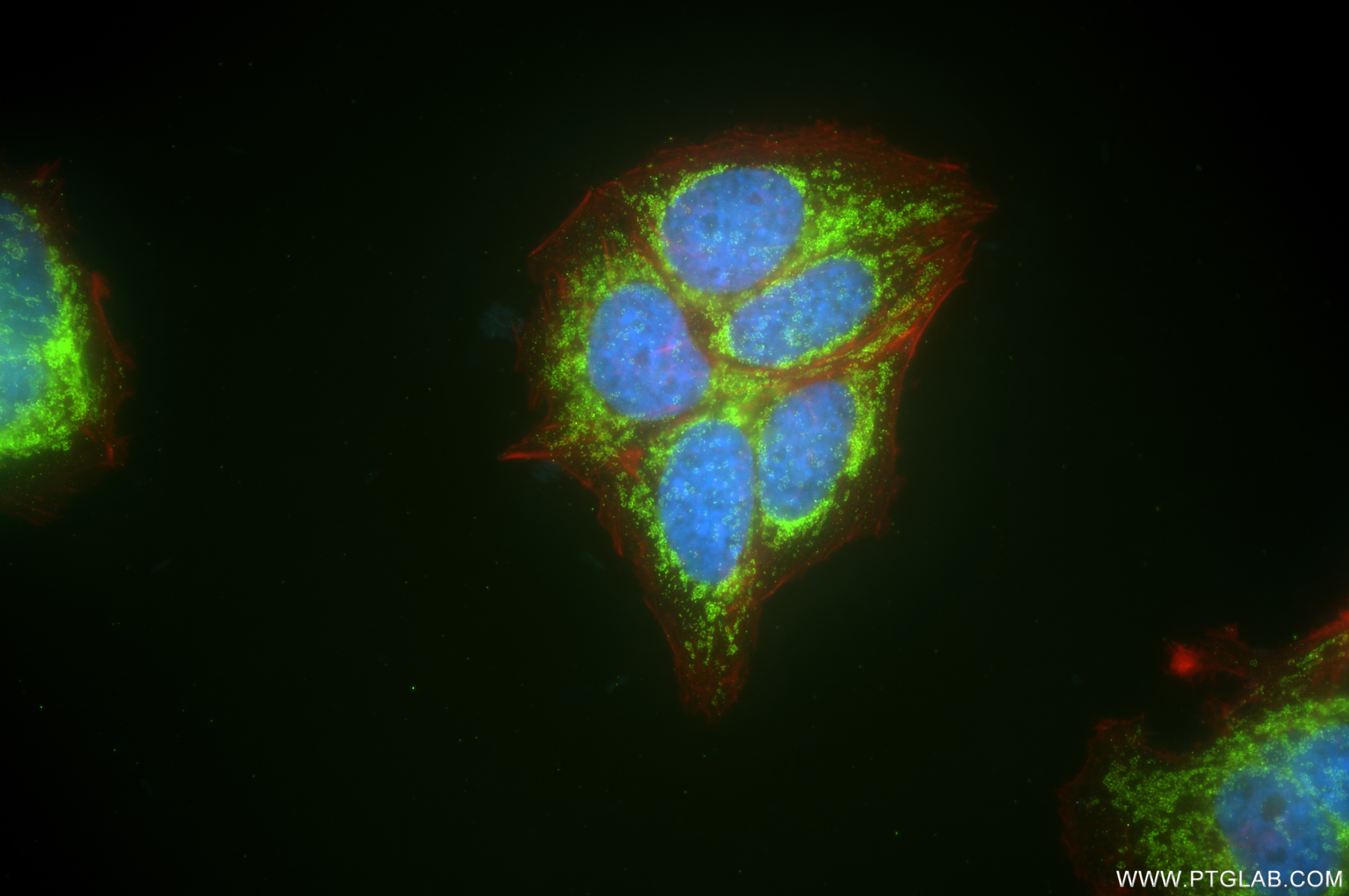 Immunofluorescence (IF) / fluorescent staining of MCF-7 cells using AKAP1 Recombinant antibody (85119-2-RR)