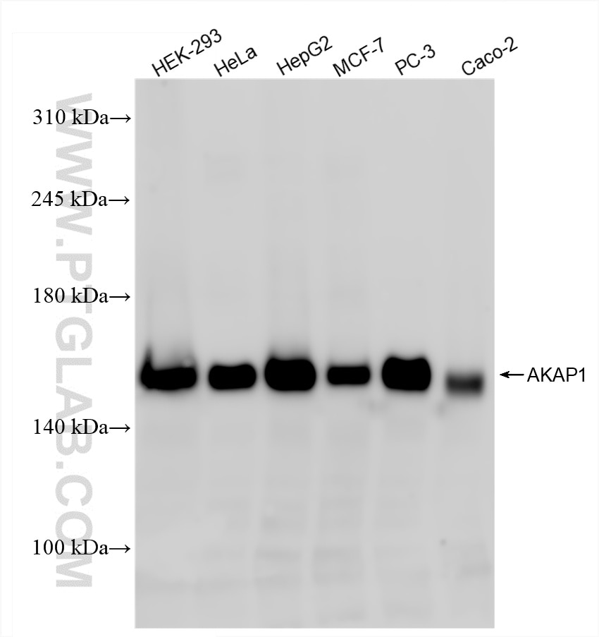 Western Blot (WB) analysis of various lysates using AKAP1 Recombinant antibody (85119-2-RR)
