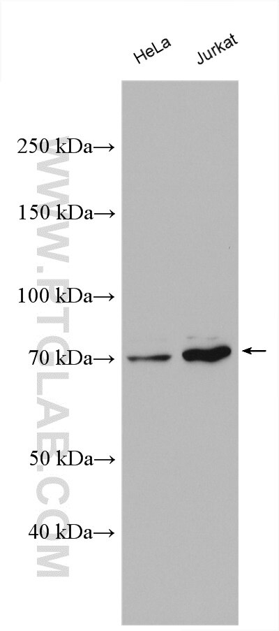 Western Blot (WB) analysis of various lysates using AKAP10 Polyclonal antibody (12356-1-AP)
