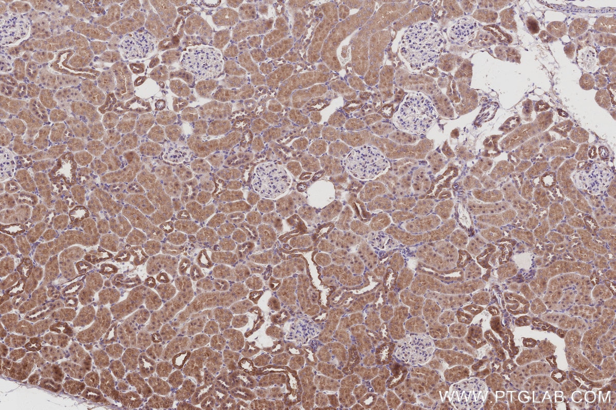 IHC staining of rat kidney using 30552-1-AP Immunohistochemistry (IHC) staining of rat kidney tissue using AKAP11-Specific Polyclonal antibody (30552-1-AP)