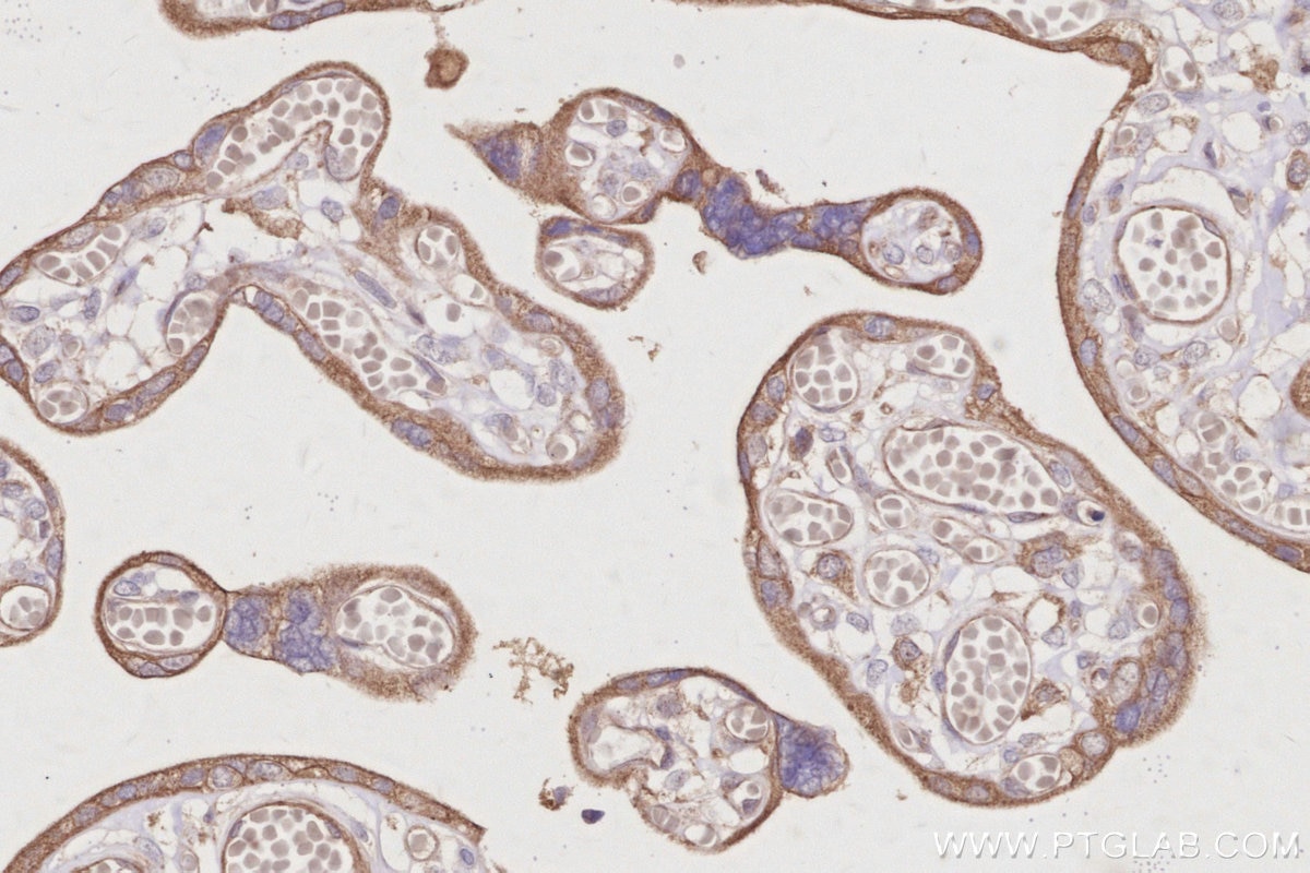 IHC staining of human placenta using 30552-1-AP Immunohistochemistry (IHC) staining of human placenta tissue using AKAP11-Specific Polyclonal antibody (30552-1-AP)
