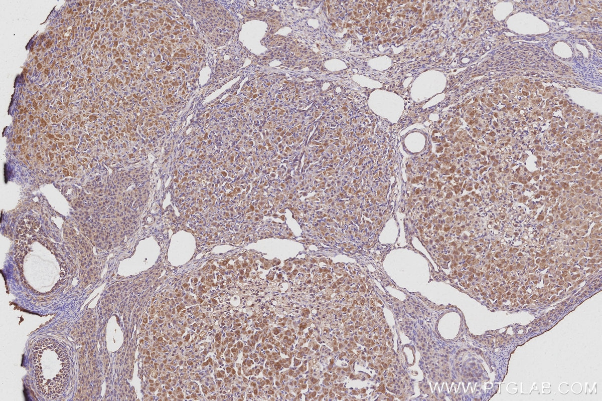 IHC staining of rat ovary using 30552-1-AP Immunohistochemistry (IHC) staining of rat ovary tissue using AKAP11-Specific Polyclonal antibody (30552-1-AP)