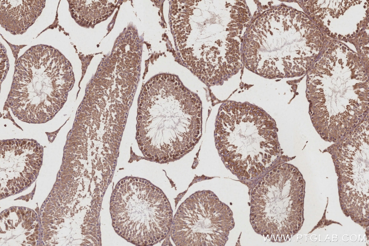 IHC staining of rat testis using 30552-1-AP Immunohistochemistry (IHC) staining of rat testis tissue using AKAP11-Specific Polyclonal antibody (30552-1-AP)