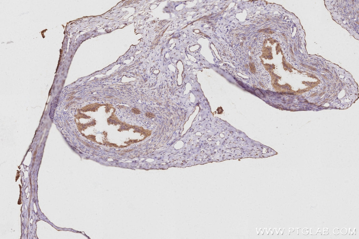 IHC staining of rat ovary using 30552-1-AP Immunohistochemistry (IHC) staining of rat ovary tissue using AKAP11-Specific Polyclonal antibody (30552-1-AP)