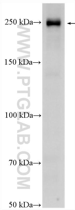 Western Blot (WB) analysis of MCF-7 cells using AKAP11-Specific Polyclonal antibody (30552-1-AP)