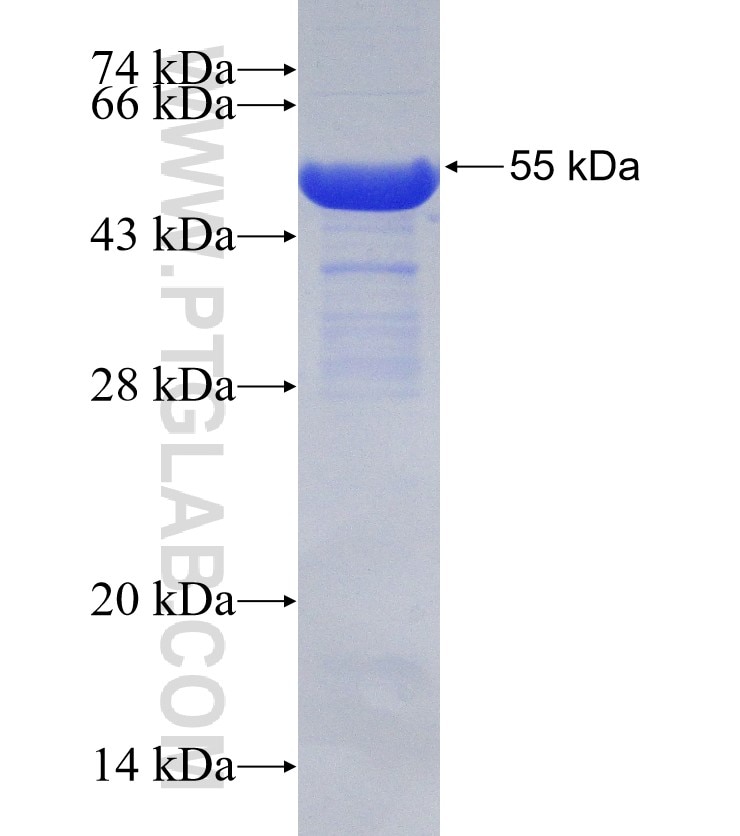 AKAP11-Specific fusion protein Ag31539 SDS-PAGE