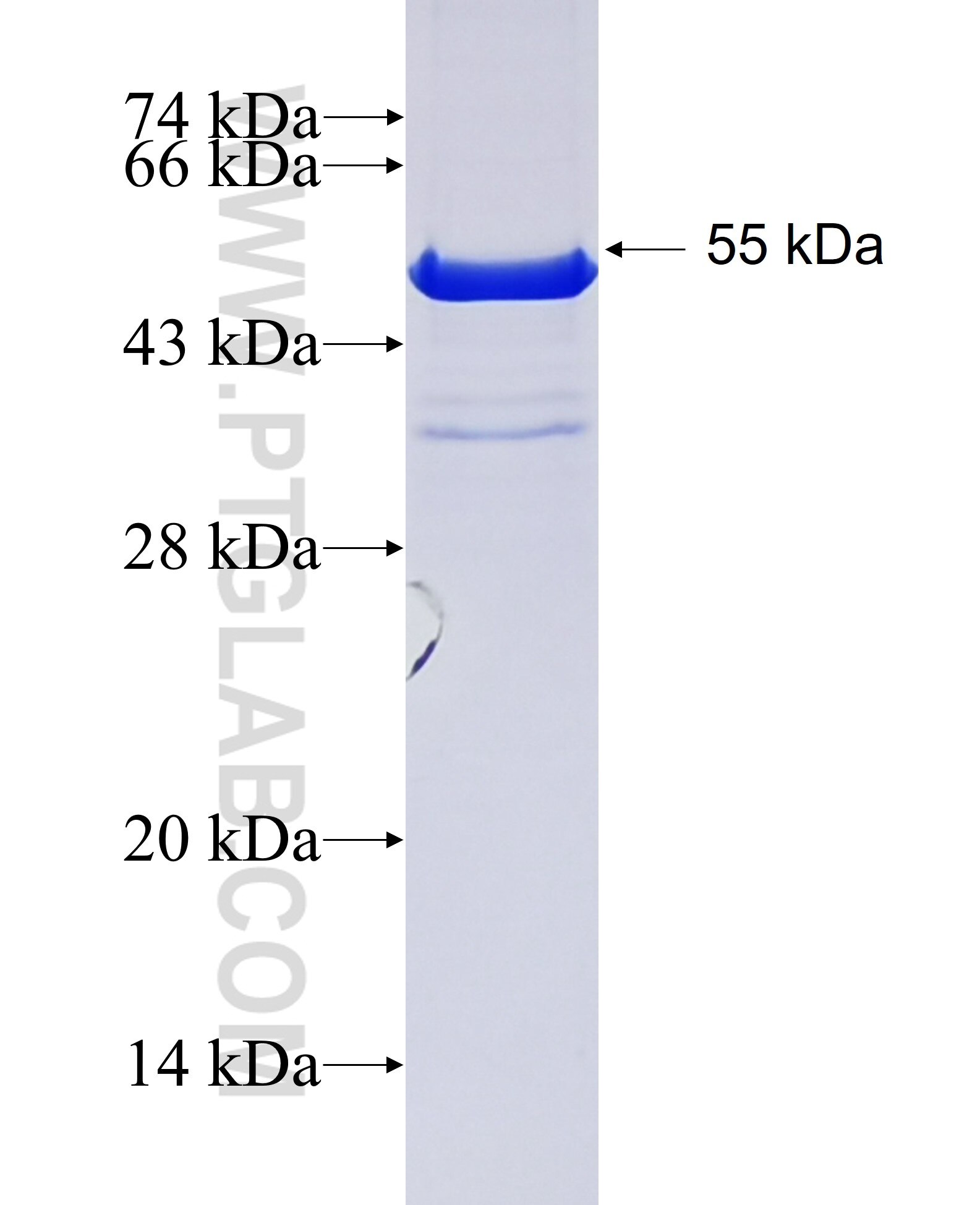 AKAP11-Specific fusion protein Ag31539 SDS-PAGE