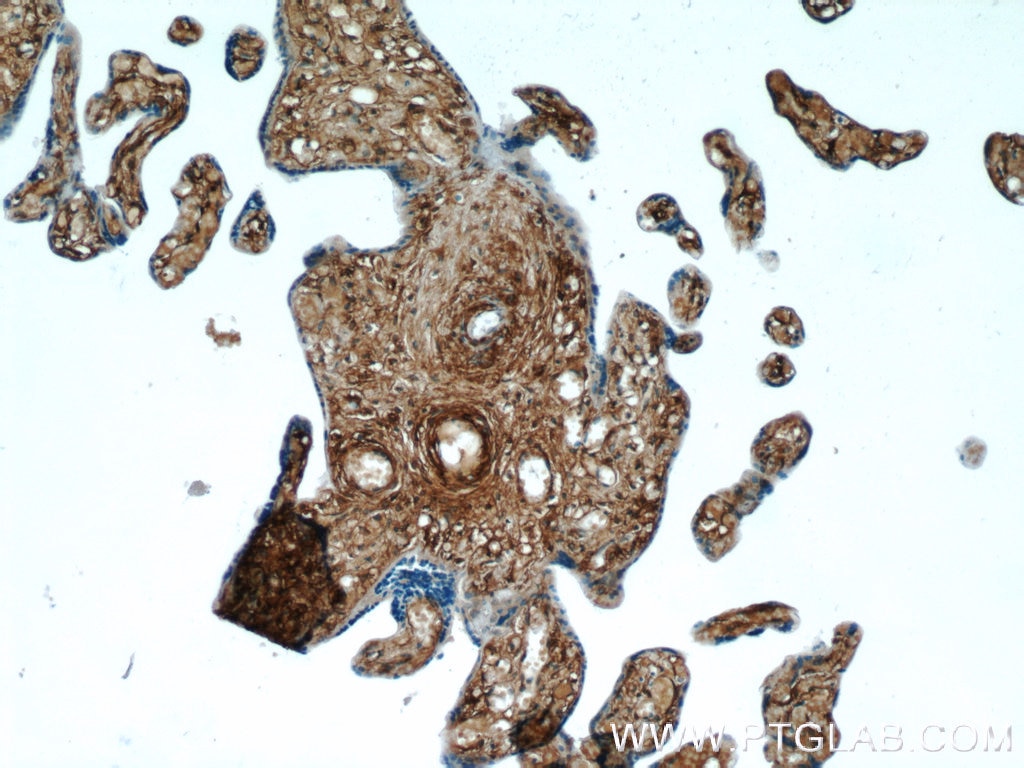 Immunohistochemistry (IHC) staining of human placenta tissue using AKAP12 Polyclonal antibody (25199-1-AP)