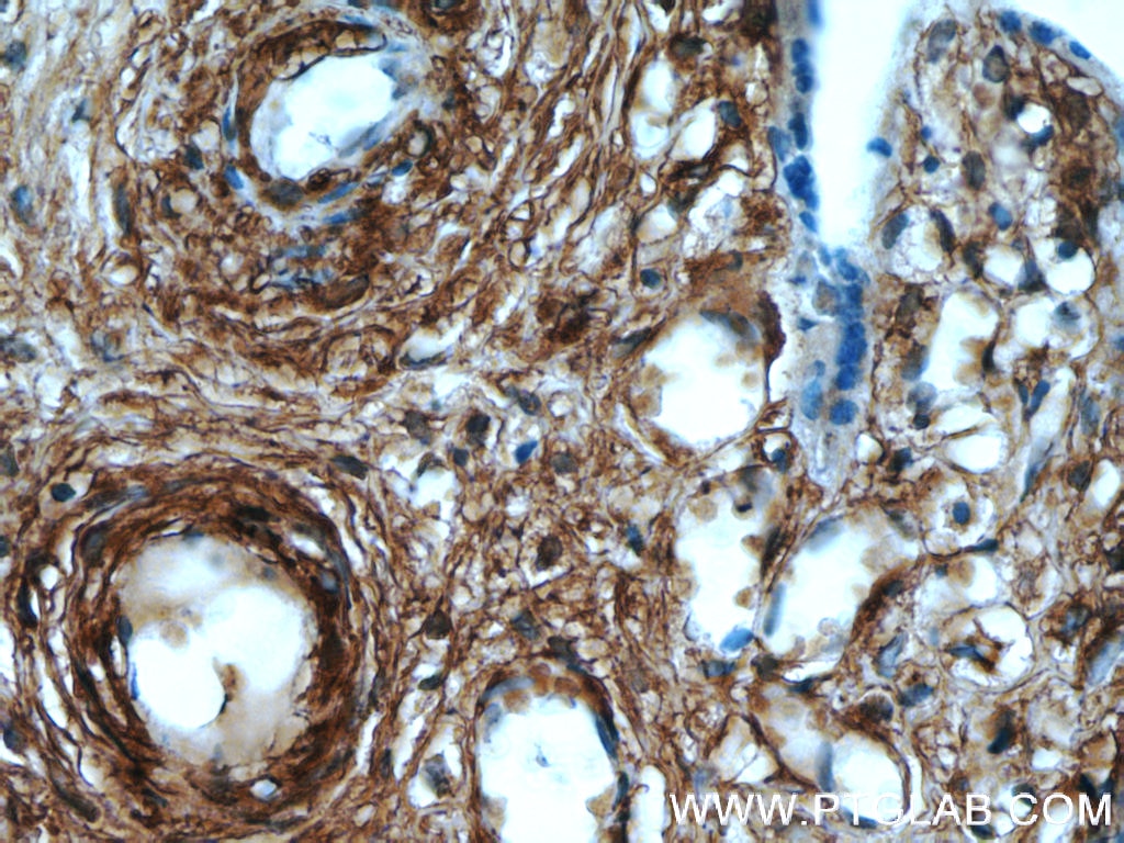 Immunohistochemistry (IHC) staining of human placenta tissue using AKAP12 Polyclonal antibody (25199-1-AP)