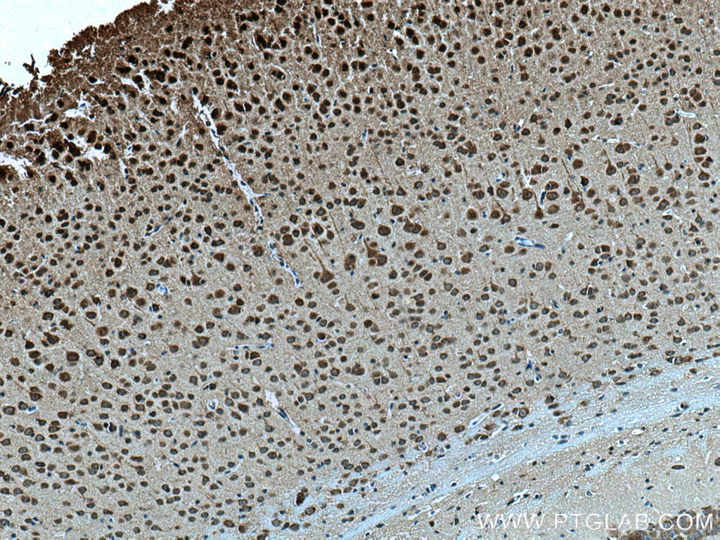 Immunohistochemistry (IHC) staining of mouse brain tissue using AKAP12 Polyclonal antibody (25199-1-AP)