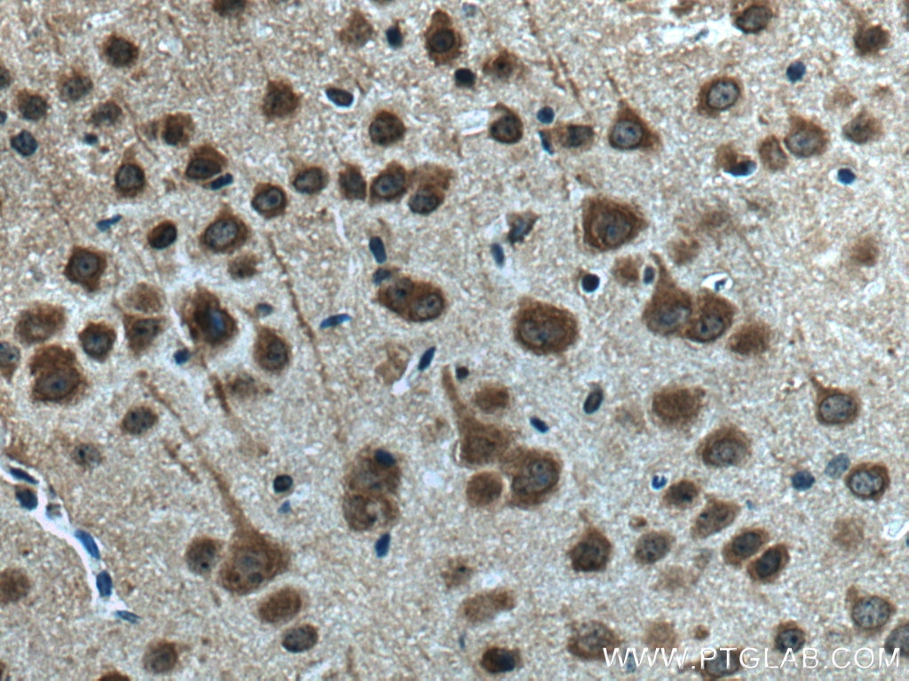 Immunohistochemistry (IHC) staining of mouse brain tissue using AKAP12 Polyclonal antibody (25199-1-AP)