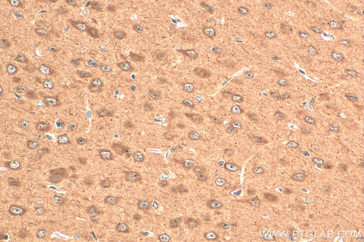Immunohistochemistry (IHC) staining of mouse brain tissue using AKAP12 Polyclonal antibody (25199-1-AP)