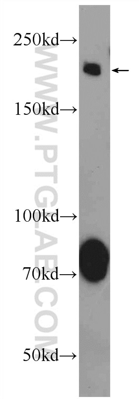 Western Blot (WB) analysis of rat brain tissue using AKAP12 Polyclonal antibody (25199-1-AP)