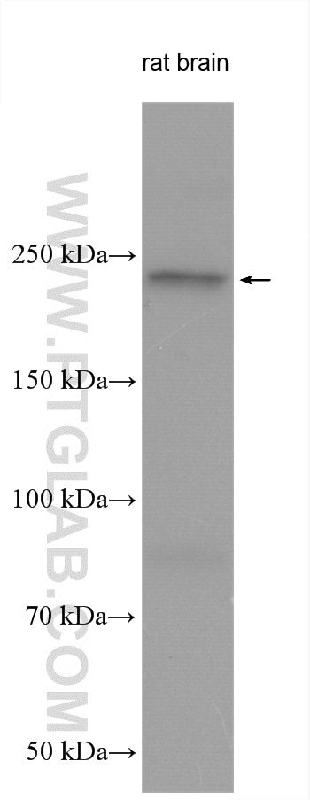Western Blot (WB) analysis of various lysates using AKAP12 Polyclonal antibody (25199-1-AP)